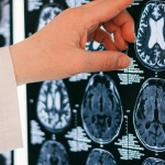 Визуализация нейронных сетей мозга при развитии толерантности